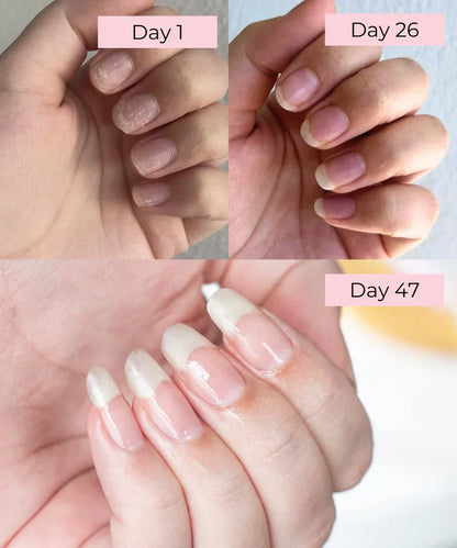 Merluna™ Nail Growth Pen