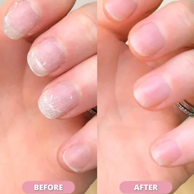 Merluna™ Nail Growth Pen